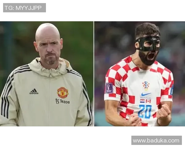 带头套的足球球星是谁 他为何选择戴上头套保护自己 带头套的足球球星是谁 他为何选择戴上头套保护自己